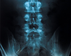 Slider image (6) Dr. GIAN PAOLO TASSI | Neurosurgery Specialist